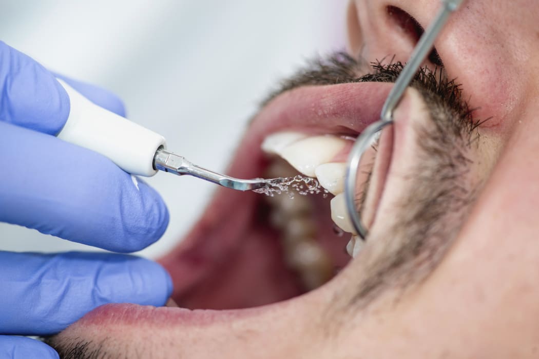 Removing dental tartar. (Photo by MICROGEN IMAGES/SCIENCE PHOTO LI / SMD / Science Photo Library via AFP)