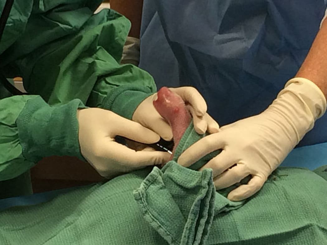 One of the giant panda cubs born Aug. 22, 2015 at the Smithsonian's National Zoo being examined by veterinarians.