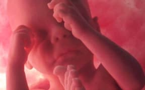 Foetus in the womb