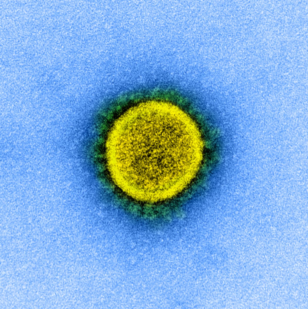 Colour enhanced transmission electron micrograph of a SARS-CoV-2 virus particle.