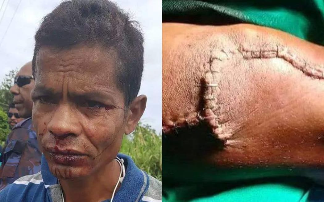 The allegedly twice assaulted refugee from Bangladesh