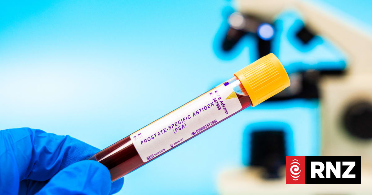Prostate Cancer Foundation warns against at-home test