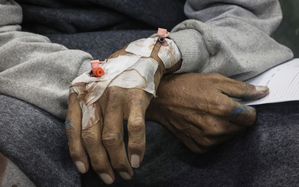 EDITORS NOTE: Graphic content / A Palestinian man who was released along with other civilians by Israeli forces after being rounded up for questioning during the latest military ground operation in Gaza receives treatment at Rafah's Al-Najjar hospital in the southern Gaza Strip on January 12, 2024, as the the war continues between Israel and the Palestinian militant group Hamas. Hamas's unprecedented attack on Israel on October 7, 2023 which left about 1,140 dead in Israel, mostly civilians, according to an AFP tally based on official figures, and saw 250 hostages dragged back into Gaza sparked the war which is still raging in the besieged Gaza Strip. After almost 100 days of war, at least 23,357 people have been killed in the fighting, the majority of them women and children, according to the Hamas health ministry -- or almost one percent of the population. (Photo by Mahmud Hams / AFP)
