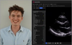 Image of Will Hewitt and a HeartLab image.