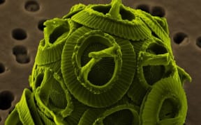 False-color scanning electron micrograph of the unicellular coccolithophore Gephyrocapsa oceanica
