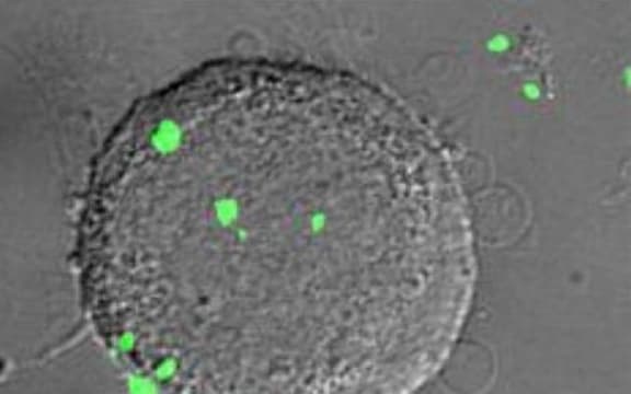Nanoparticles on a single cell.