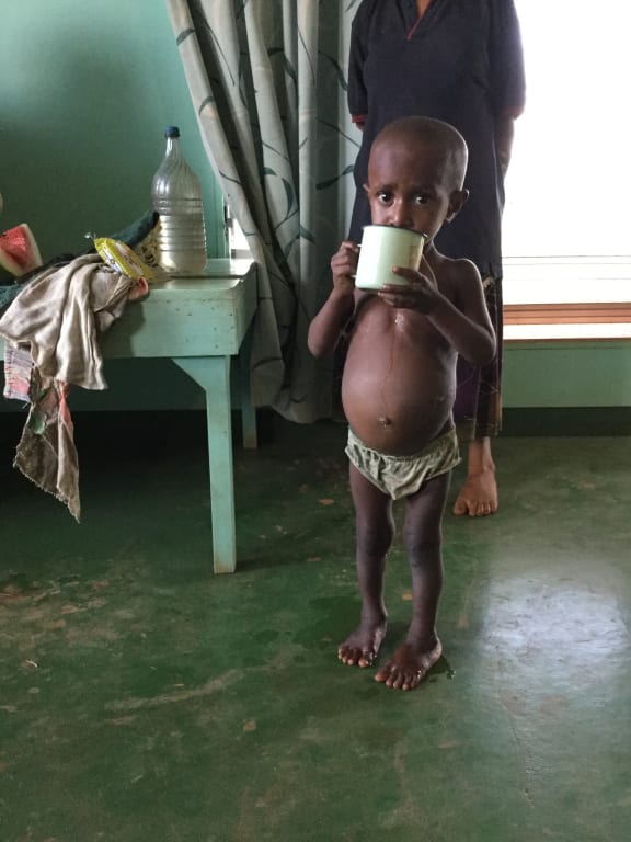 A malnourished child in PNG has a drink of water. His equally malnourished pregnant mother walked two days to reach the clinic going into labour along the way and giving birth to twin girls one of whom did not survive.