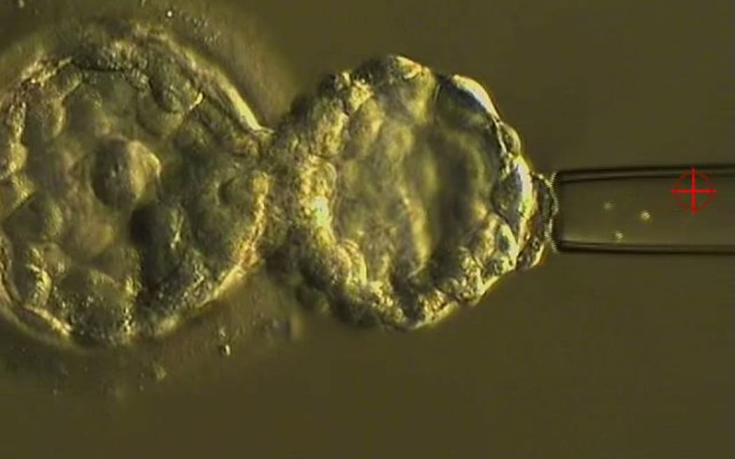A human embryo at about six days old undergoing pre-implantation genetic testing to determine if it has too many chromosomes.