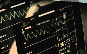 Heart monitor