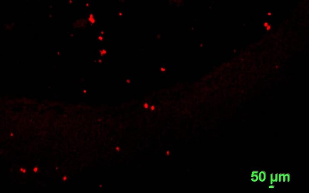 Microplastics visible after the application of dye. The scale is 50 microns, or 0.05 of a millimetre.