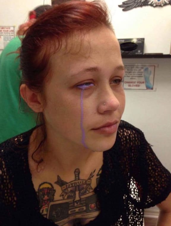 Catt Gallinger posted images on social medida to raise awareness of the dangers of scleral tattooing.