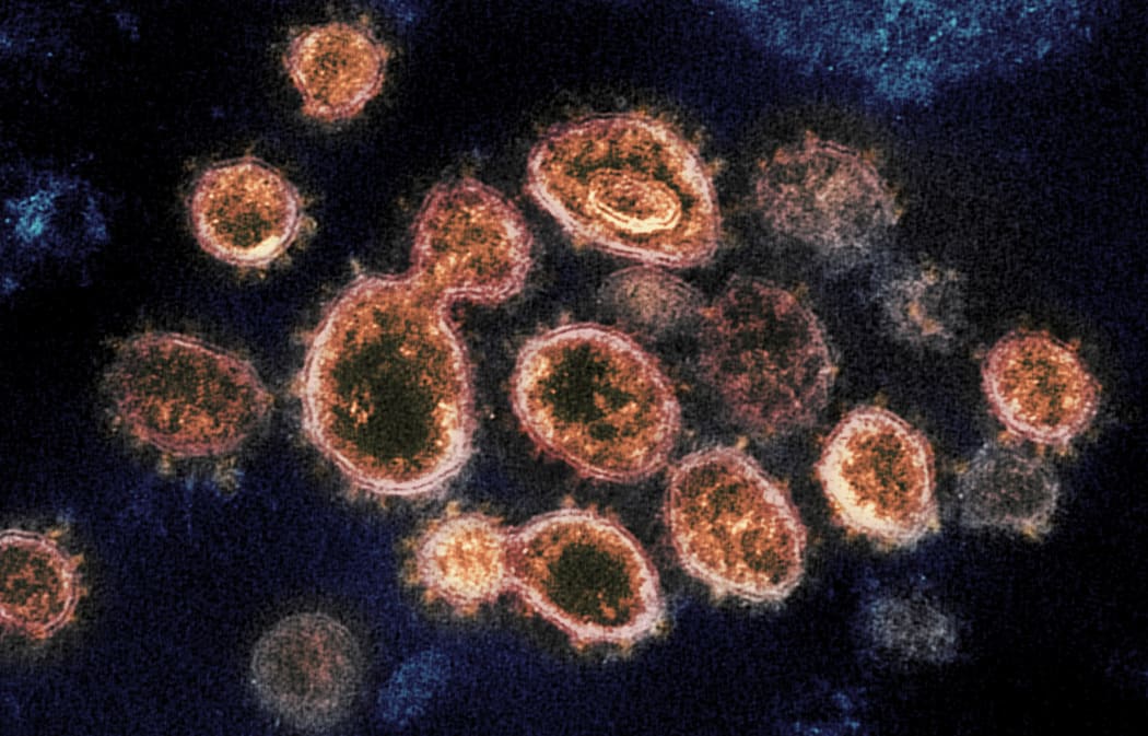 Novel Coronavirus SARS-CoV-2 This transmission electron microscope image shows SARS-CoV-2, the virus that causes Covid-19, isolated from a patient in the US. Virus particles are shown emerging from the surface of cells cultured in the lab.
