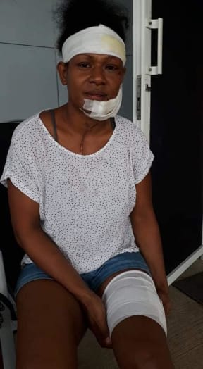 PNG rugby and boxing representative was assaulted by her partner as her children watched on.