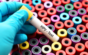 HPV test tube.
