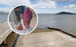 A Rotorua man has been fighting an infection in his foot after standing on a piece of metal at a public boat ramp. Photos / Andrew Warner, supplied