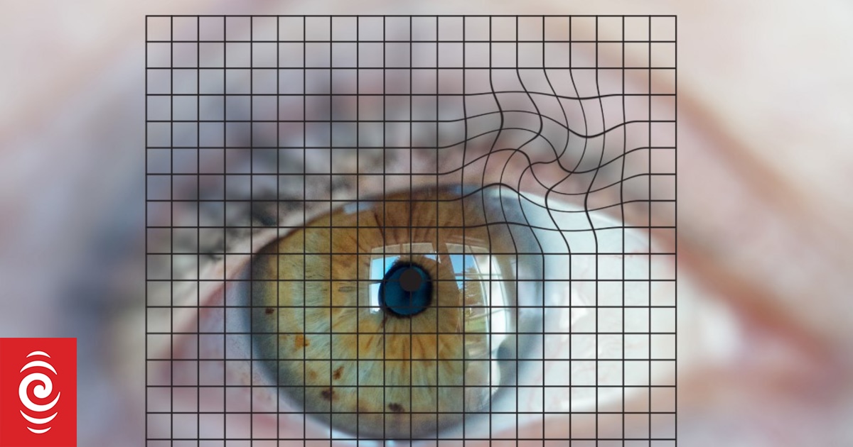 New technology developed for eye disease early detection | RNZ