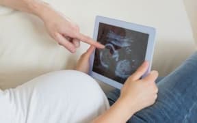 Prospective parents look at an ultrasound of a pregnancy.