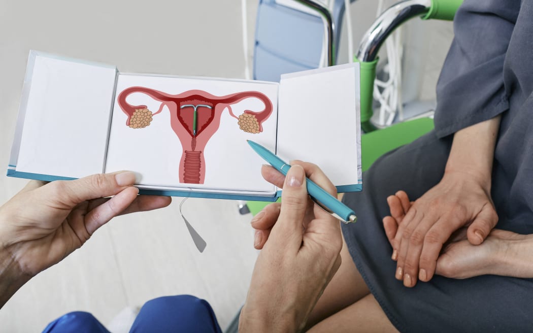 IUD consultation, conceptual image. (Photo by PEAKSTOCK / SCIENCE PHOTO LIBRAR / LDA / Science Photo Library via AFP)