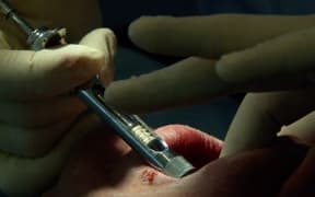 A baby boomer dentistry tsunami is on its way a report says.