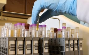SEATTLE, WA - FEBRUARY 12: Researchers at the UW Medicine Retrovirology Research Lab at Harborview Medical Center work on samples from the Novavax phase 3 Covid-19 clinical vaccine trial on February 12,