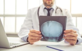 Handsome medical doctor in white coat is examining radiograph while working in his office