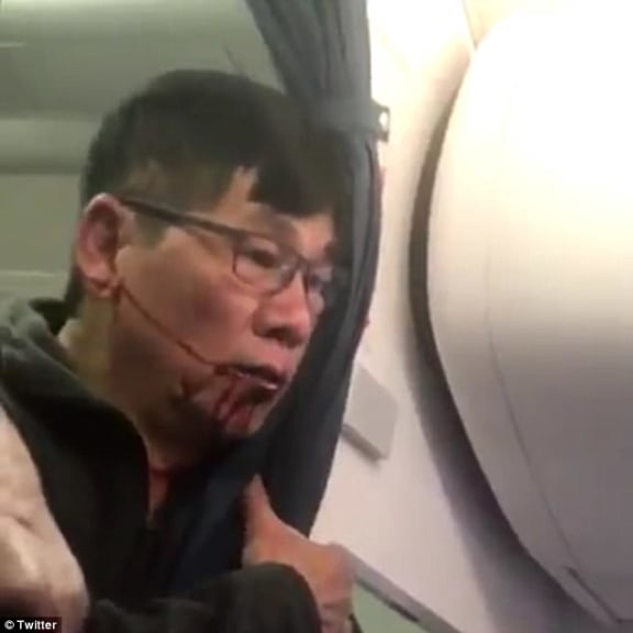 The man is pictured bleeding from the mouth after he was dragged off the overbooked United Airlines flight.
