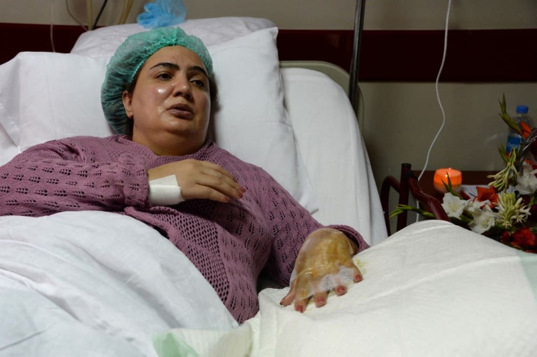 In this photograph taken on November 21, 2014, Afghan member of Parliament Shukria Barakzai speaks during an interview with AFP as she recuperates at a government hospital in Kabul following an assassination attempt.