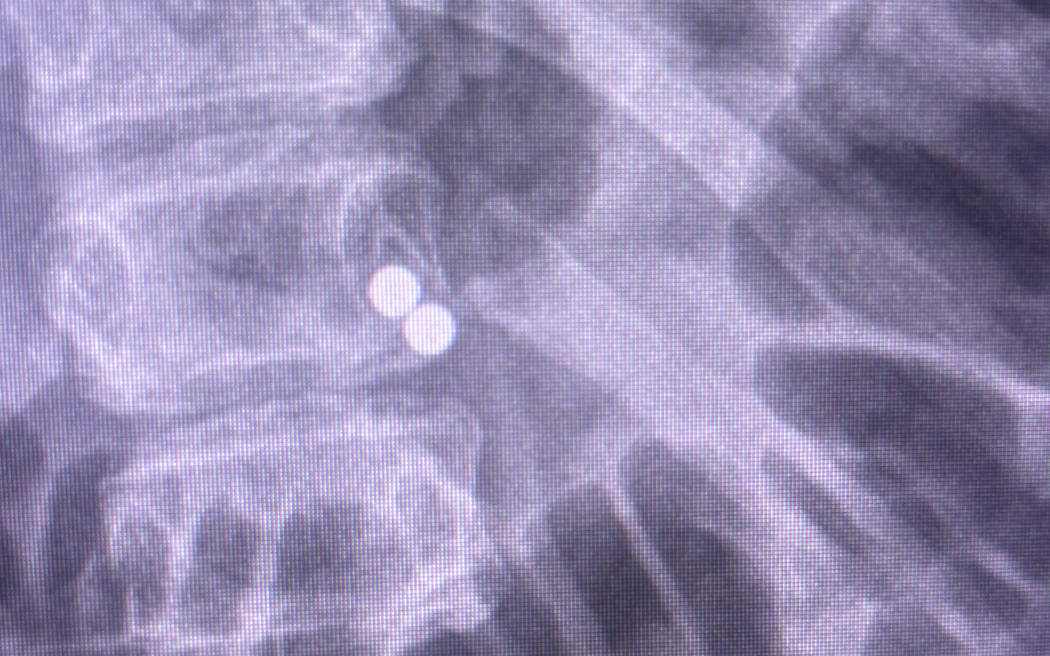 An X-ray of the magnets.