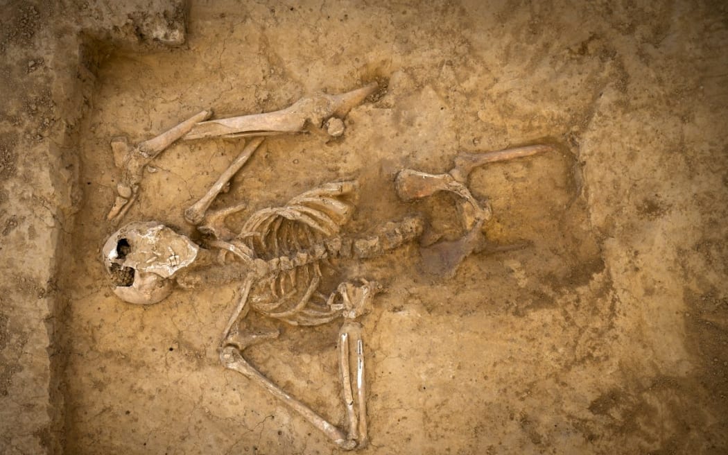 An articulated skeleton of a solider from the Battle of Waterloo