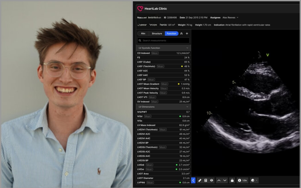 Image of Will Hewitt and a HeartLab image.