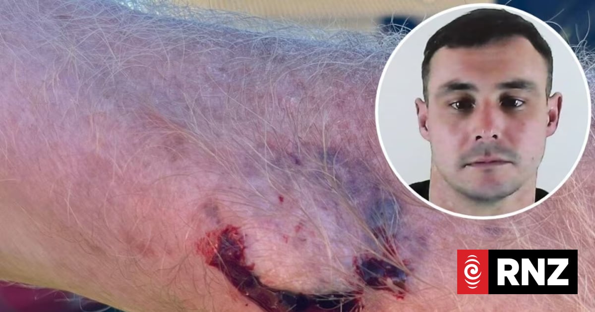 Drink driver Finnian Crook jailed for biting pensioner after Richmond crash