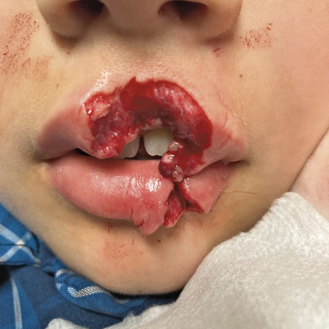 Poppy (not her real name) was left with horrific injuries after a dog attack in December 2020.