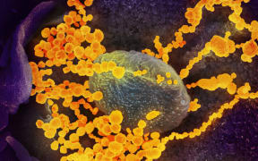 Novel Coronavirus SARS-CoV-2 ; This scanning electron microscope image shows SARS-CoV-2 (round gold objects) emerging from the surface of cells cultured in the lab. SARS-CoV-2, also known as 2019-nCoV, is the virus that causes COVID-19. The virus shown was isolated from a patient in the U.S.