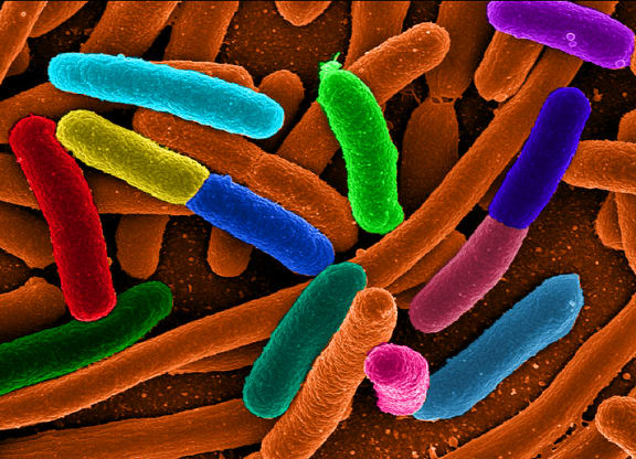 Escherichia coli - one of the many species of bacteria present in the human gut