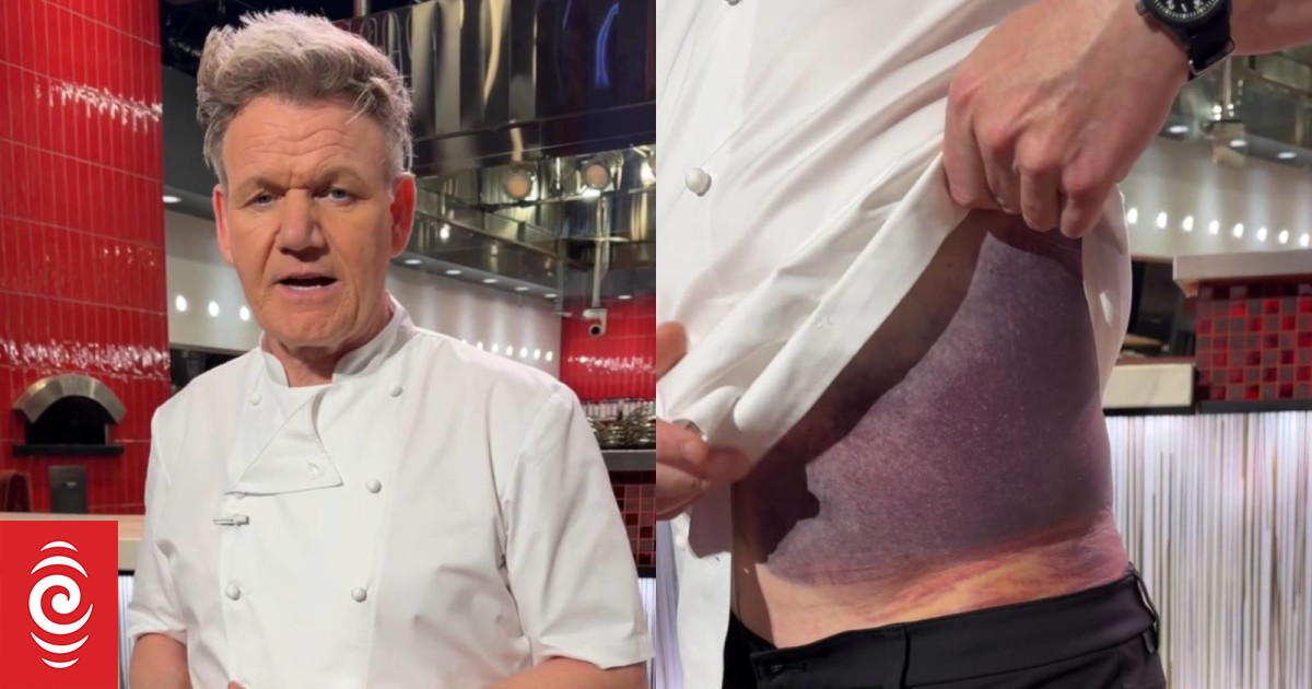 Gordon Ramsay urges cyclists to wear helmets after nasty accident | RNZ ...