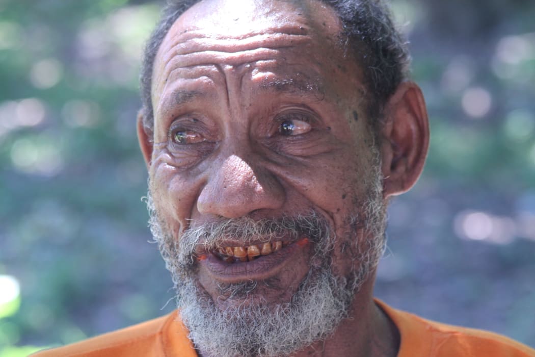 Eye care is lacking in many parts of the Pacific.