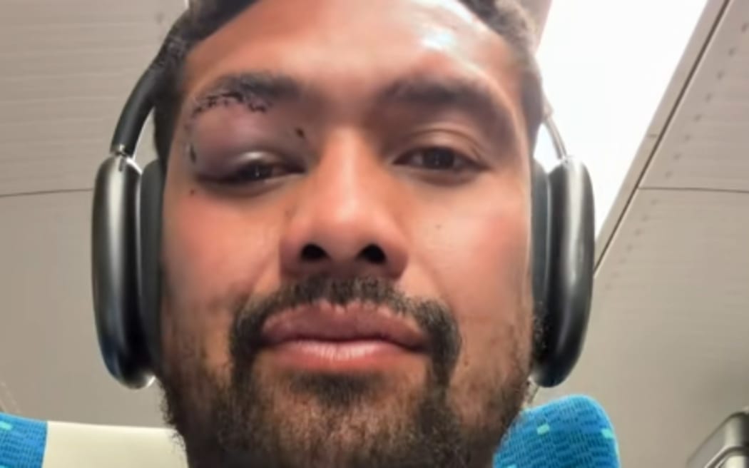 Ardie Savea sporting a nasty eye injury in Japan.