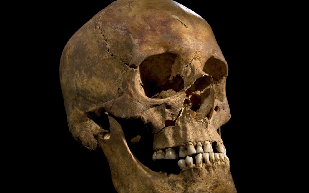 The skull of Richard III who died at the Battle of Bosworth - the last English monarch to die in battle.