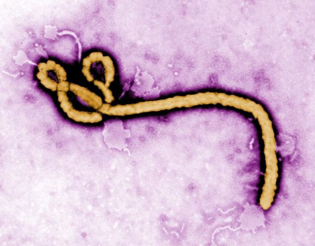 Ebola Virus up close