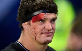 New Zealand’s Scott Barrett with a blood injury after the game