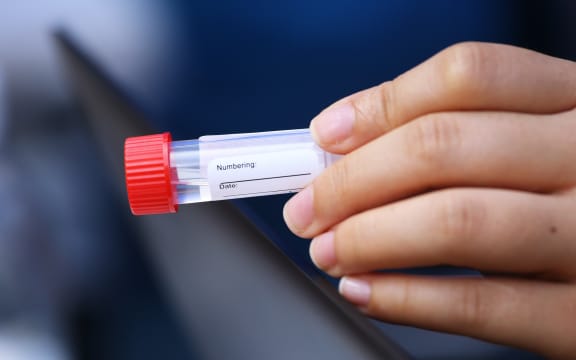 Sample bottle for collecting saliva specimens at a Covid-19 testing station in Hong Kong.