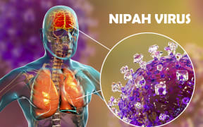 Encephalitis and pneumonia caused by Nipah viruses, computer illustration. Nipah virus is zoonotic (transmitted to humans from animals) and was first found in Malaysia and Singapore in people who had close contact with pigs. It was initially isolated in 1999 upon examining samples from an outbreak of encephalitis and respiratory illness among adult men in those two countries. (Photo by KATERYNA KON/SCIENCE PHOTO LIBRA / KKO / Science Photo Library via AFP)