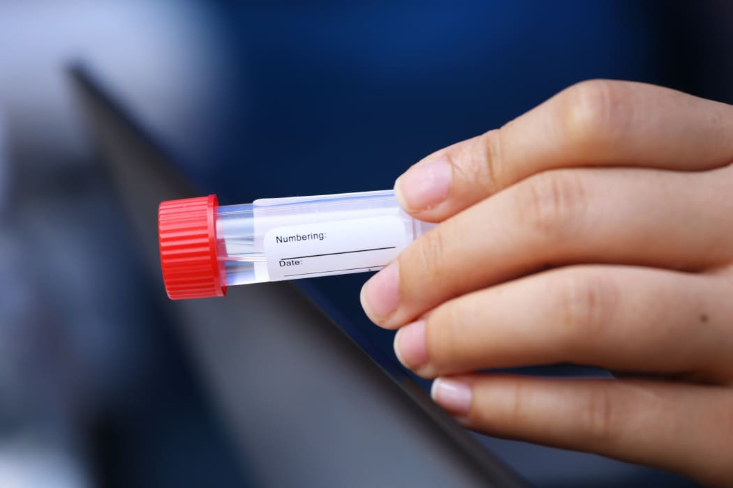 Sample bottle for collecting saliva specimens at a Covid-19 testing station in Hong Kong.