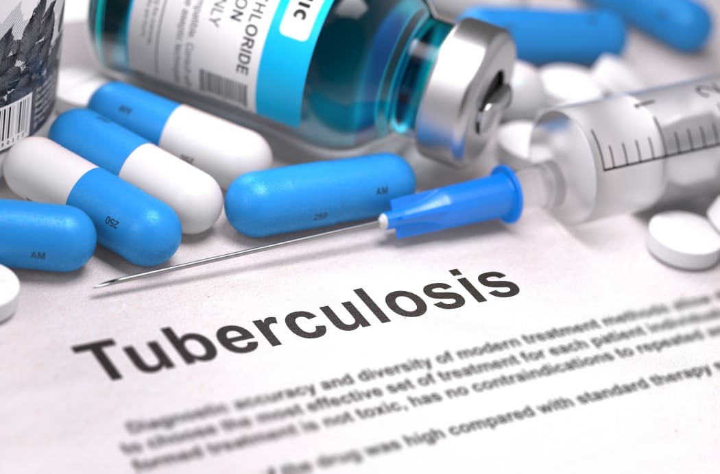 Tuberculosis