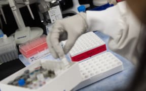 In this file photo Dr. Nita Patel, Director of Antibody discovery and Vaccine development, lifts a vial with a potential coronavirus, COVID-19, vaccine at Novavax labs in Gaithersburg, Maryland, US on 20 March 2020.