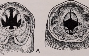 Necator americanus (right) showing cutting ridges.