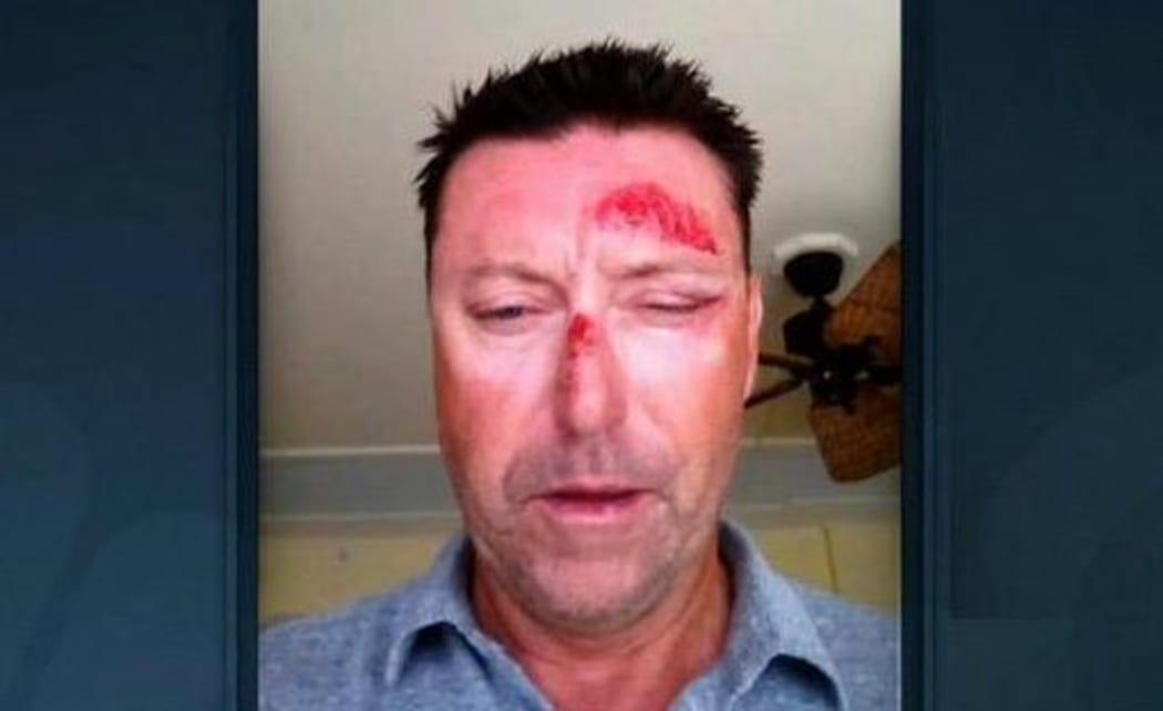 Australian golfer Robert Allenby
