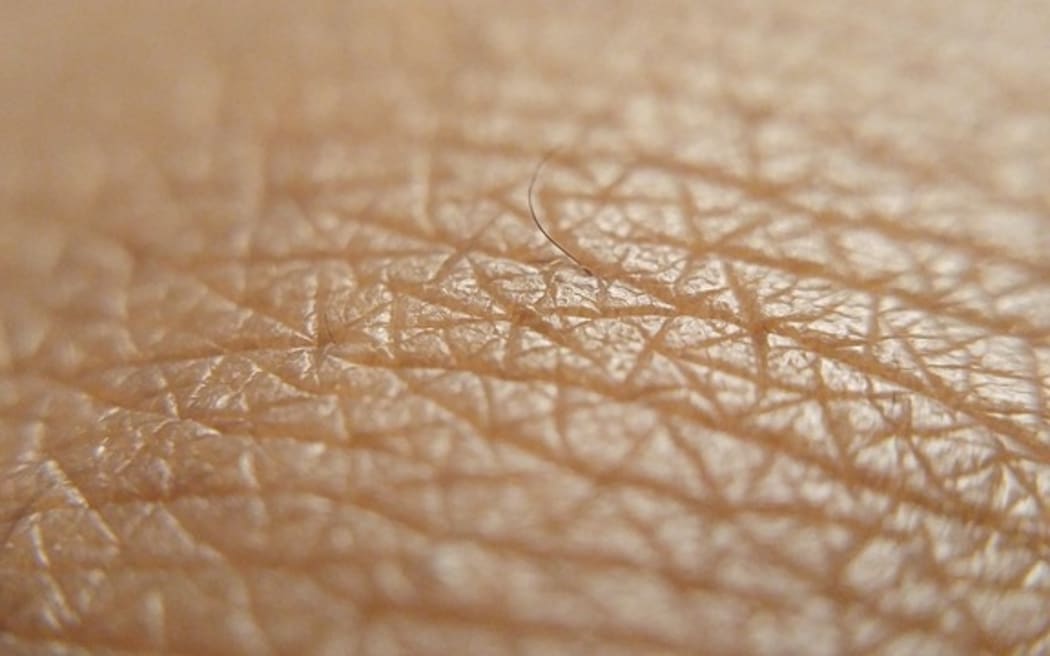Skin