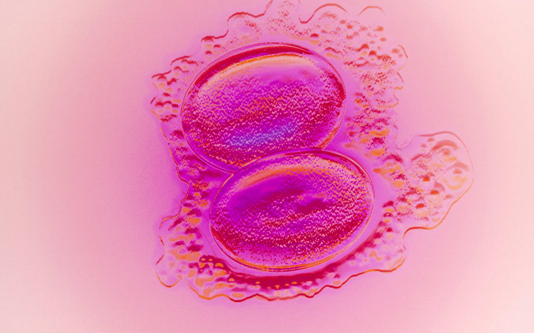 A two cell embryo