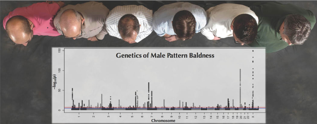 Genetics of Male Pattern Baldness